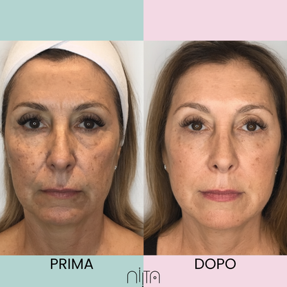 Trattamento Mirato Anti-Age