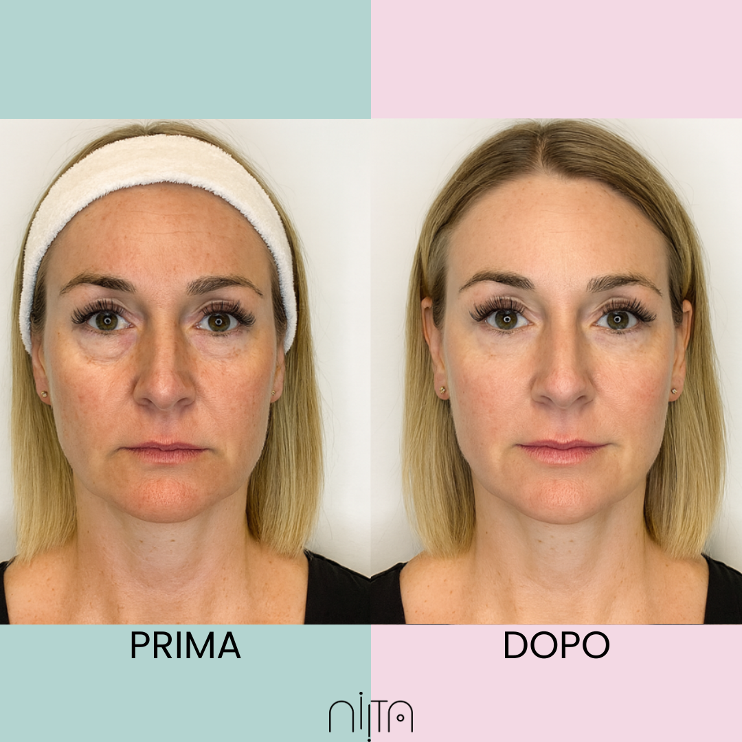 Trattamento Mirato Anti-Age