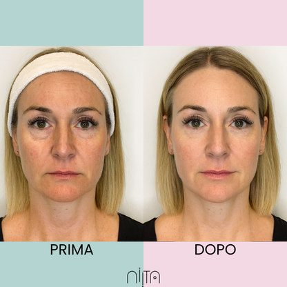 Trattamento Mirato Anti-Age