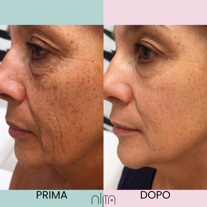 Trattamento Mirato Anti-Age