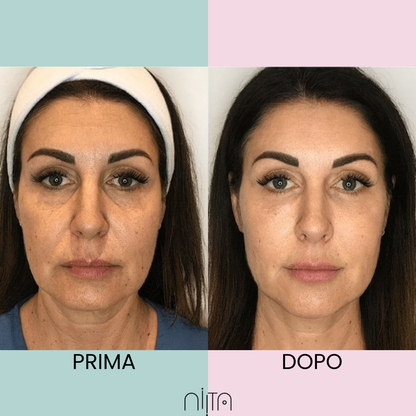 Trattamento Mirato Anti-Age