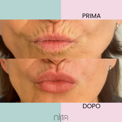 Trattamento Mirato Anti-Age